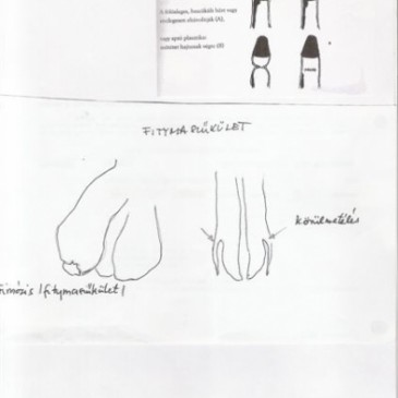 A potenciazavar diagnosztizálása. orvoslási módjai